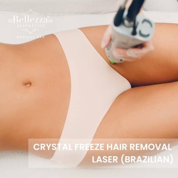 Crystal Freeze Hair Removal Laser (Brazilian) Trial (U.P. $588)