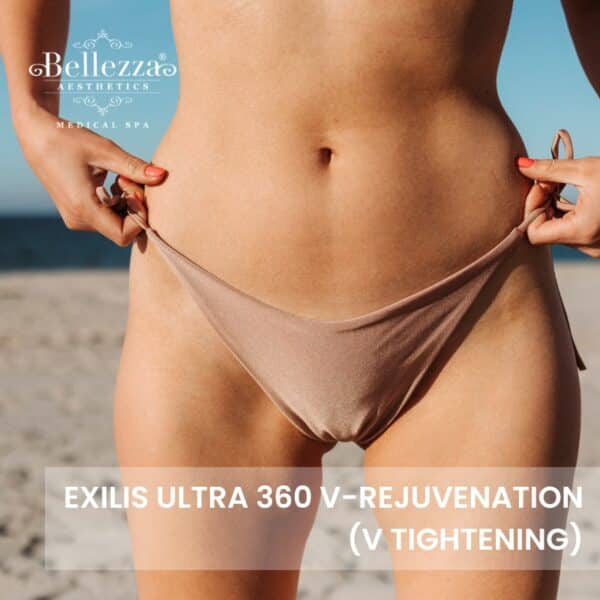 Exilis Ultra 360 V-Rejuvenation Trial (U.P. $2,800)