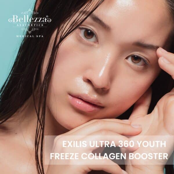 Exilis Ultra 360 Youth Freeze Collagen Booster (Exilis Eye) Trial – Exclusive at Wheelock Place (U.P. $588)