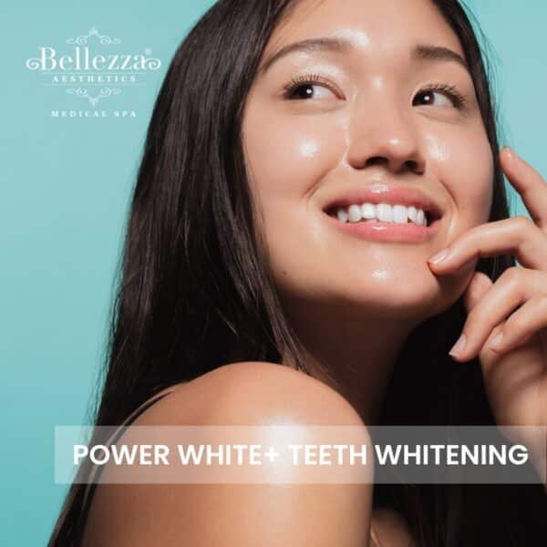 Power White+ Teeth Whitening​ Trial (U.P. $1,288)