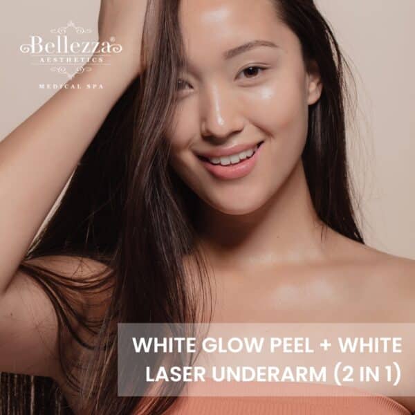 White Glow Peel + White Laser Underarm Trial (U.P. $588)