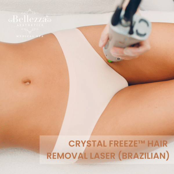 Crystal Freeze™ Hair Removal Laser (Brazilian) Trial (U.P. $588)