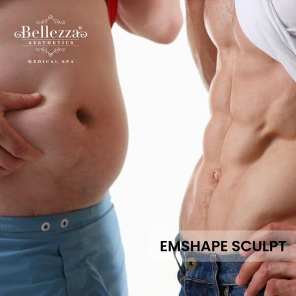 Emshape Sculpt​ (Men) Trial (U.P. $588)